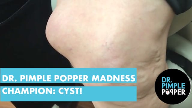 Dr. Pimple Popper's Madness CHAMPION!...