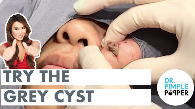 Try the Grey Cyst! 
