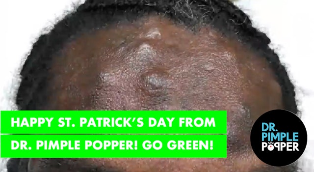 Happy St Patrick's Day from Dr Pimple Popper! Go GREEN!