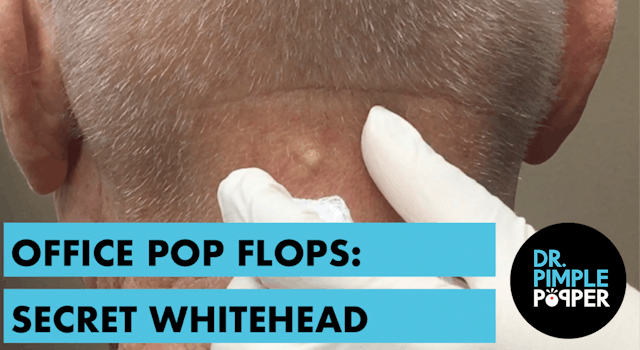 Office Pop Flops: Secret Whitehead 