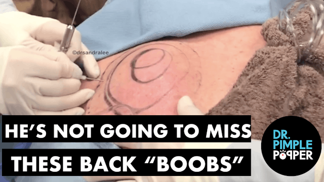 (Part 1) He's Not Going To Miss These Back "Boobs"