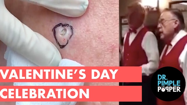 A Dr. Pimple Popper Valentine's Day Celebration