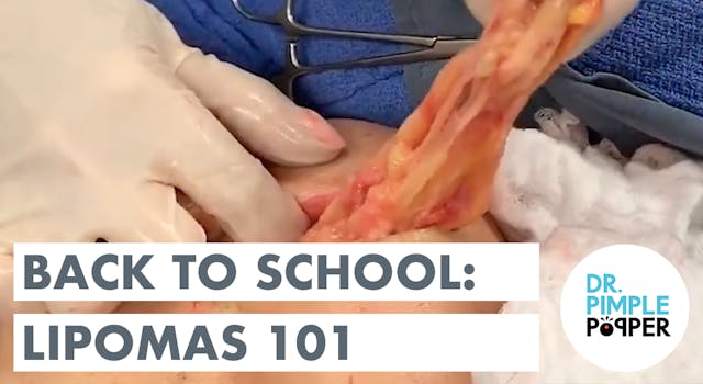 Back to School with Dr. Pimple Popper...