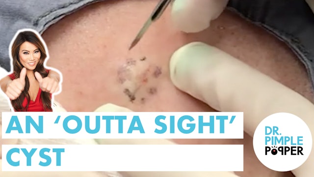 Queen of Pops' Pick: An 'Outta Sight' Cyst