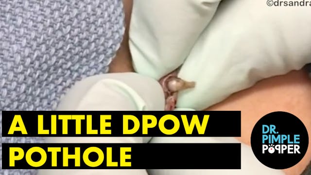 A Little DPOW Pothole