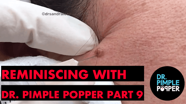 Reminiscing with Dr. Pimple Popper - ...