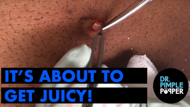 It's About to get JUICY in here!