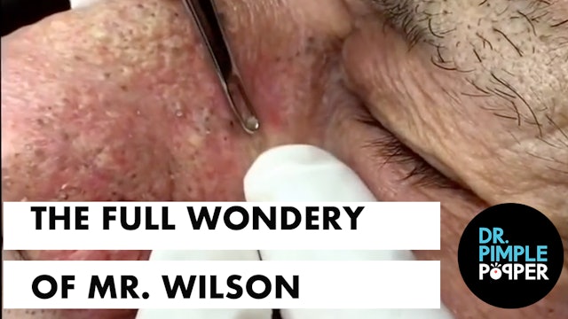 The Full Wondery of Mr. Wilson