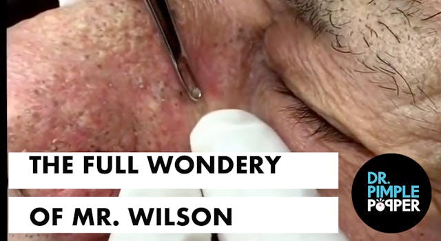 The Full Wondery of Mr. Wilson