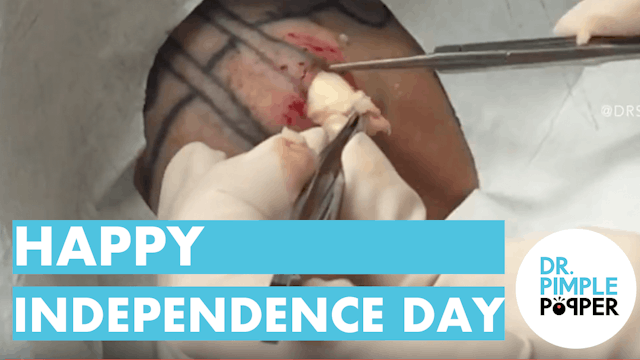 Happy Independence Day, from Dr Pimple Popper!