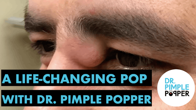 A Life Changing Pop with Dr. Pimple Popper