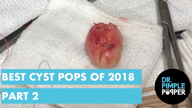 Best of Cysts Part Two, 2018