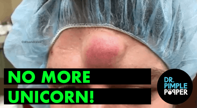No More Unicorn, with Dr Pimple Popper