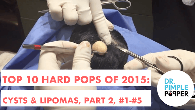 My Top 10 BEST Hard Pops of 2015: Cys...