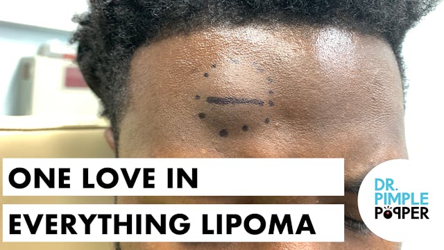 One Love in Everything... Lipoma