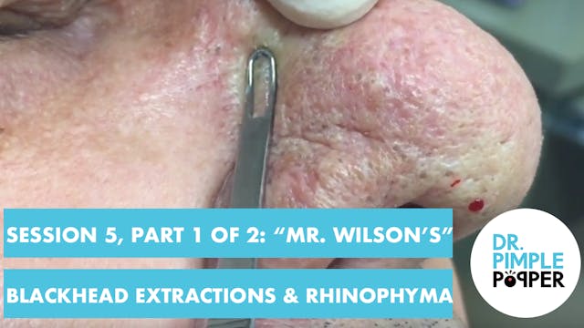 Session 5, Part 1 of 2: "Mr Wilson's"...