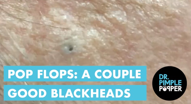 Office Pop Flop: A Couple GOOD Blackheads