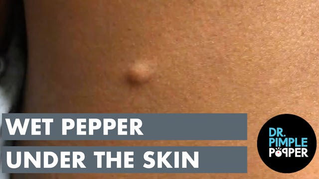 Wet Pepper Under the Skin