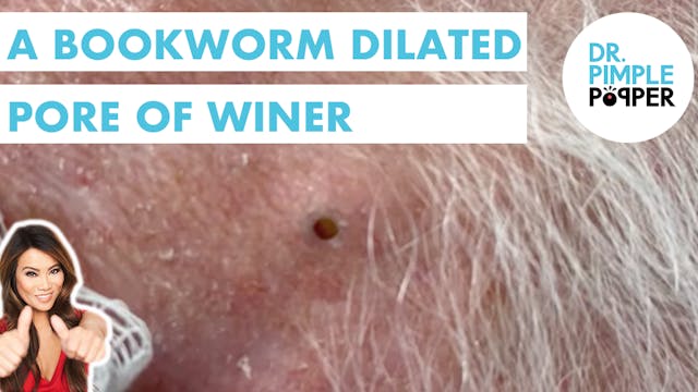 A Bookworm Dilated Pore of Winer