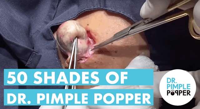 50 Shades of Dr. Pimple Popper (Part 1)
