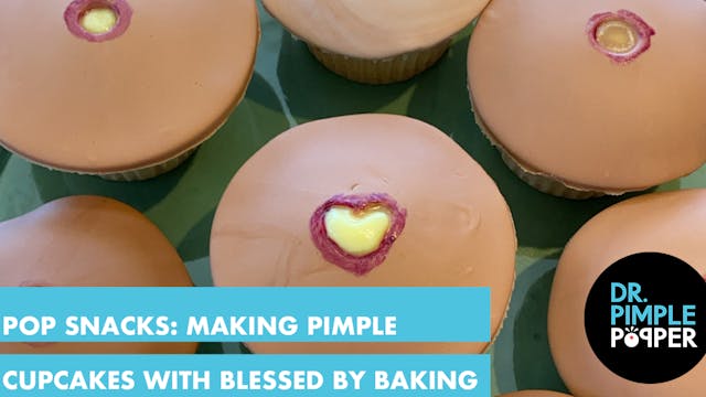 POP SNACKS: Making Pimple Cupcakes wi...