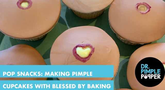 POP SNACKS: Making Pimple Cupcakes with Dr. Pimple Popper & Blessed By Baking!