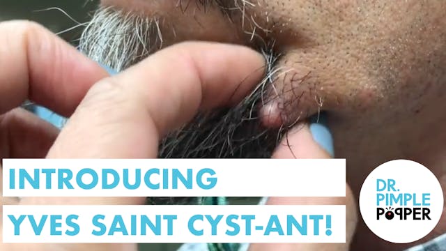 Introducing: Yves Saint Cyst-ent