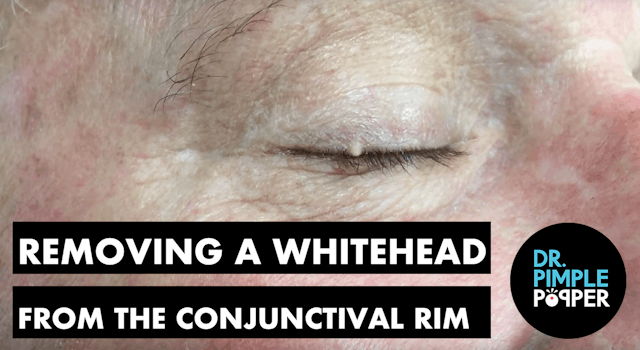 Removing a Whitehead from the Conjunc...