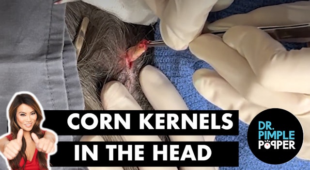 Corn Kernels in the Head
