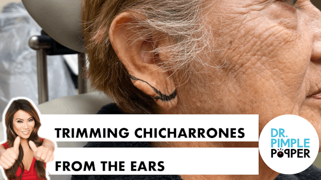 Trimming Chicharrones from the Earlobe