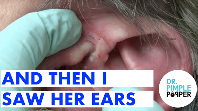 And Then I Saw Her Ears