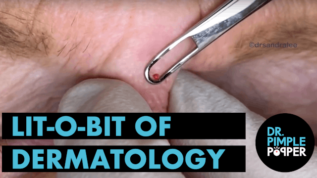 Lit-O-Bit of Dermatology