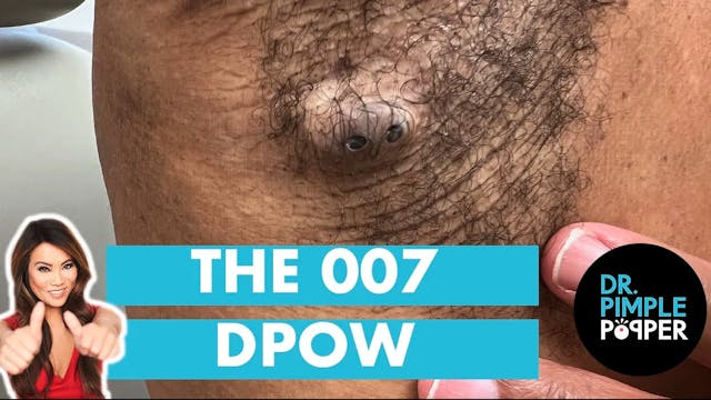 The 007 DPOW
