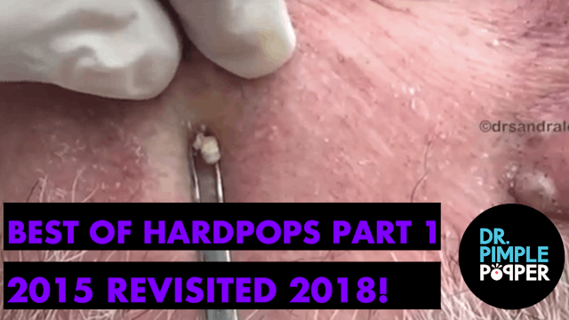 Best of Hardpops Part 1 2015 Revisite...