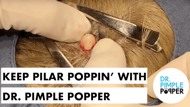 Keep Pilar Poopin' with Dr Pimple Pop...