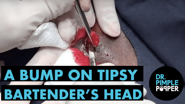 There's a BUMP on Tipsy Bartender's h...