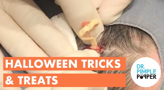 Dr. Pimple Popper: Halloween Tricks &...