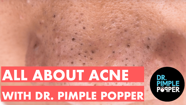 All About Acne with Dr. Pimple Popper