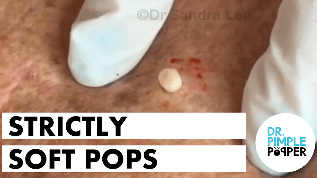Watch Dr. Pimple Popper: Before the Pop Season 1 on TLC 