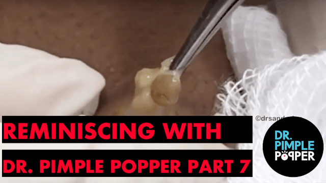 Reminiscing with Dr. Pimple Popper, T...