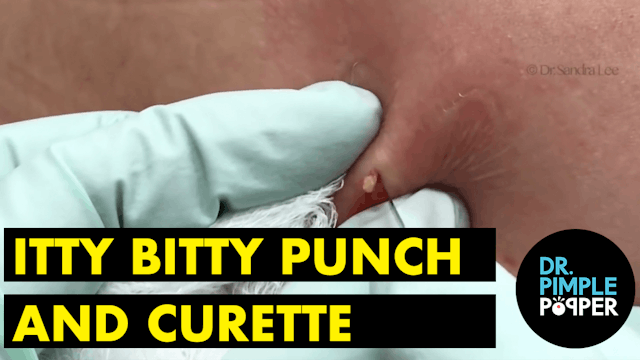 Itty Bitty Punch & Curette