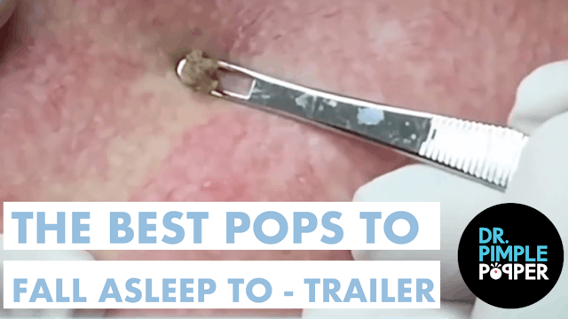 A Dr. Pimple Popper Bedtime Story - Trailer