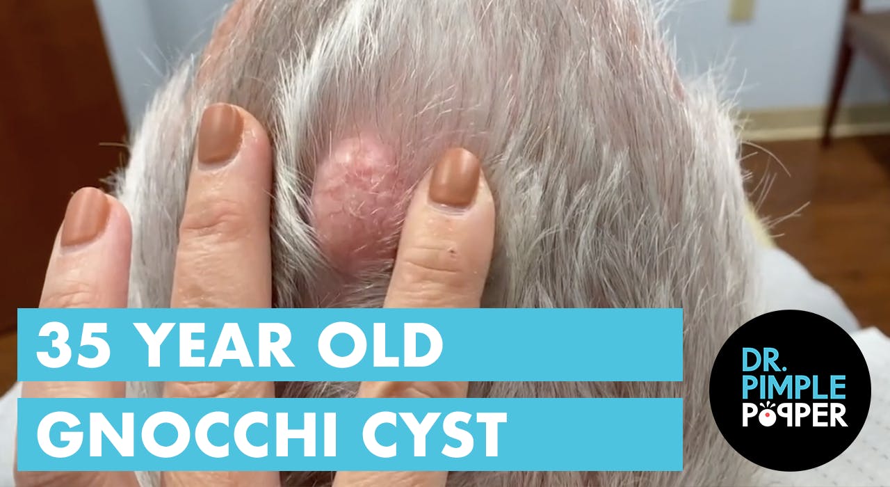 can dogs get pilar cysts