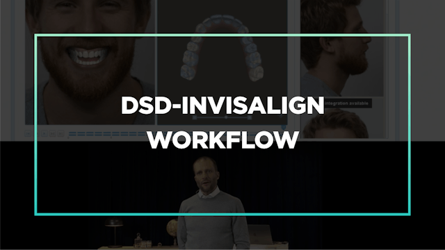 Part 2 Ep 2: DSD-Invisalign Workflow