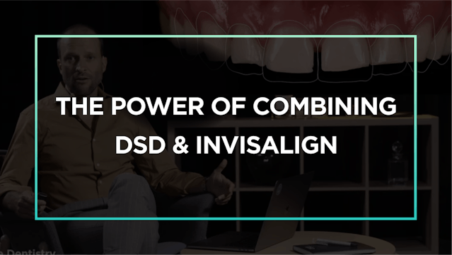 The power of combining DSD & Invisalign