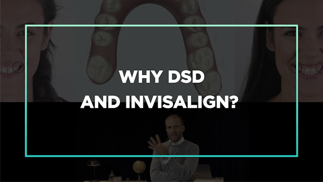 Part 2 Ep 1: Why DSD and Invisalign?