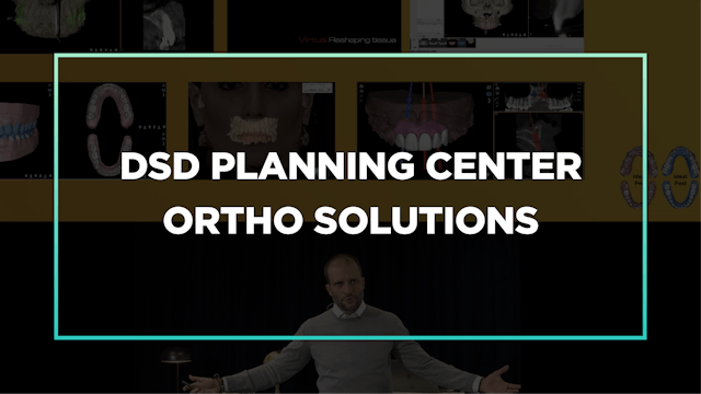 Part 2 Ep 3: The DSD Planning Center Ortho Solutions
