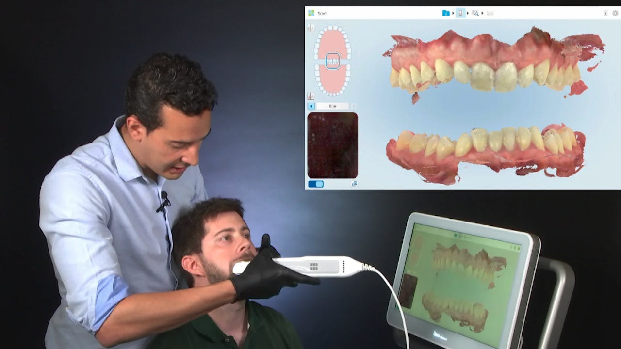 Certification 4. Using the iTero Intra Oral Scanner (4) Occlusion