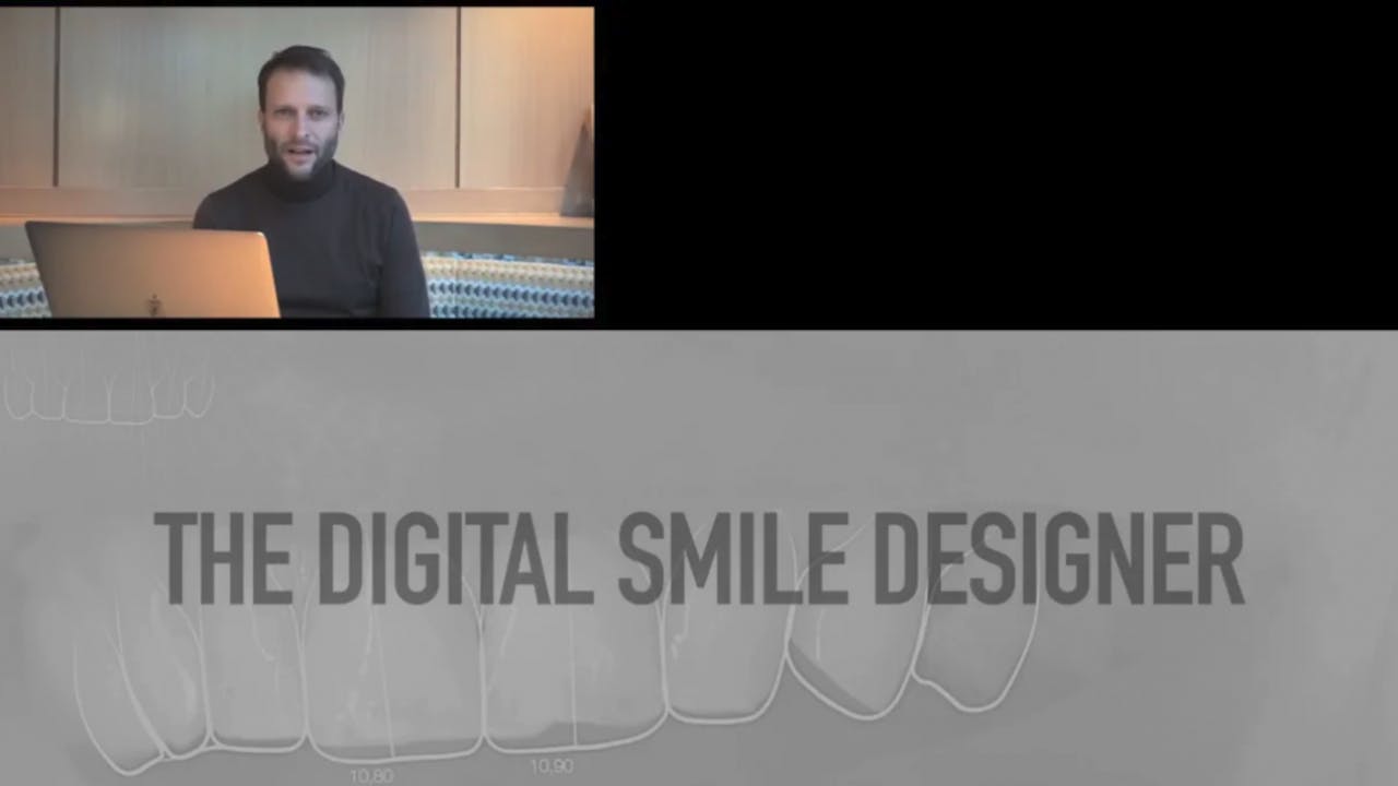 DSD and Aligners Dr. Christian Coachman Orthodontic Aligner