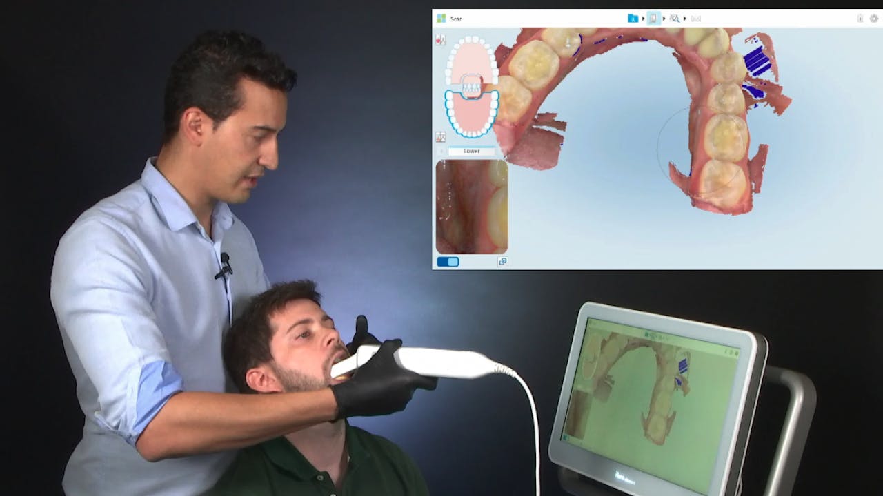 Certification 4. Using the iTero Intra Oral Scanner (2) Lower arch